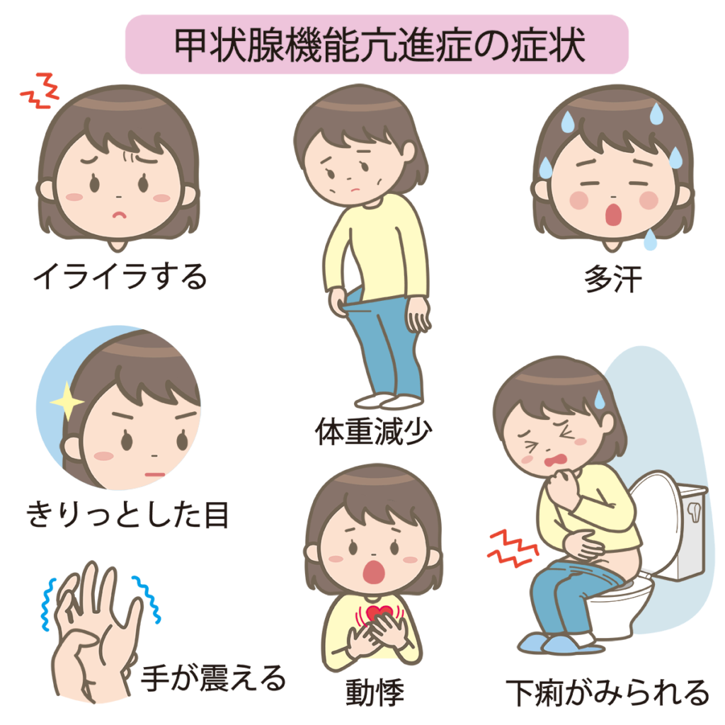 バセドウ病神戸芦屋